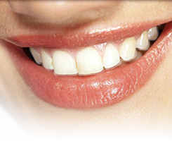 Invisalign Clear Aligners